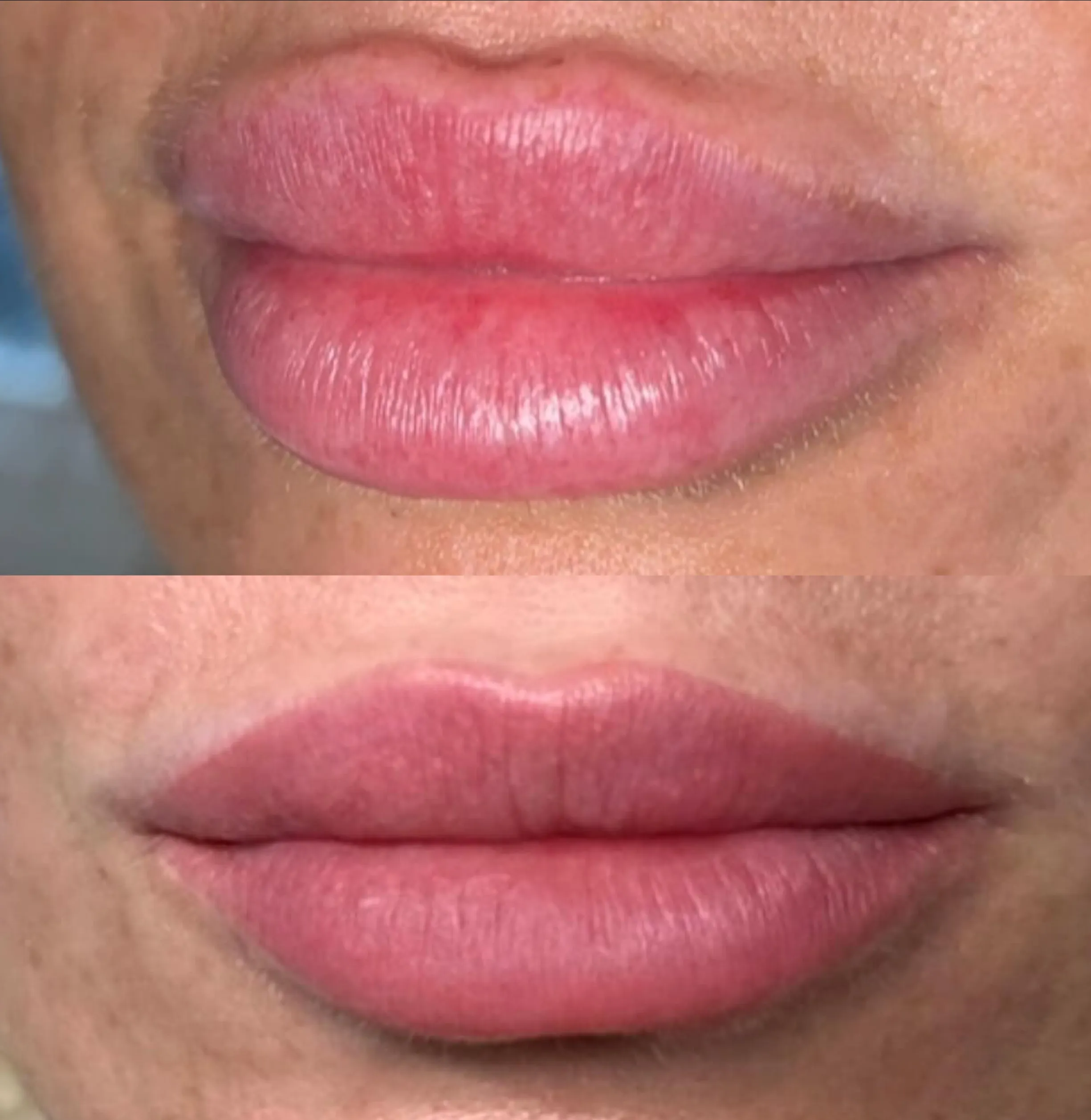 lip cosmetic tattoo