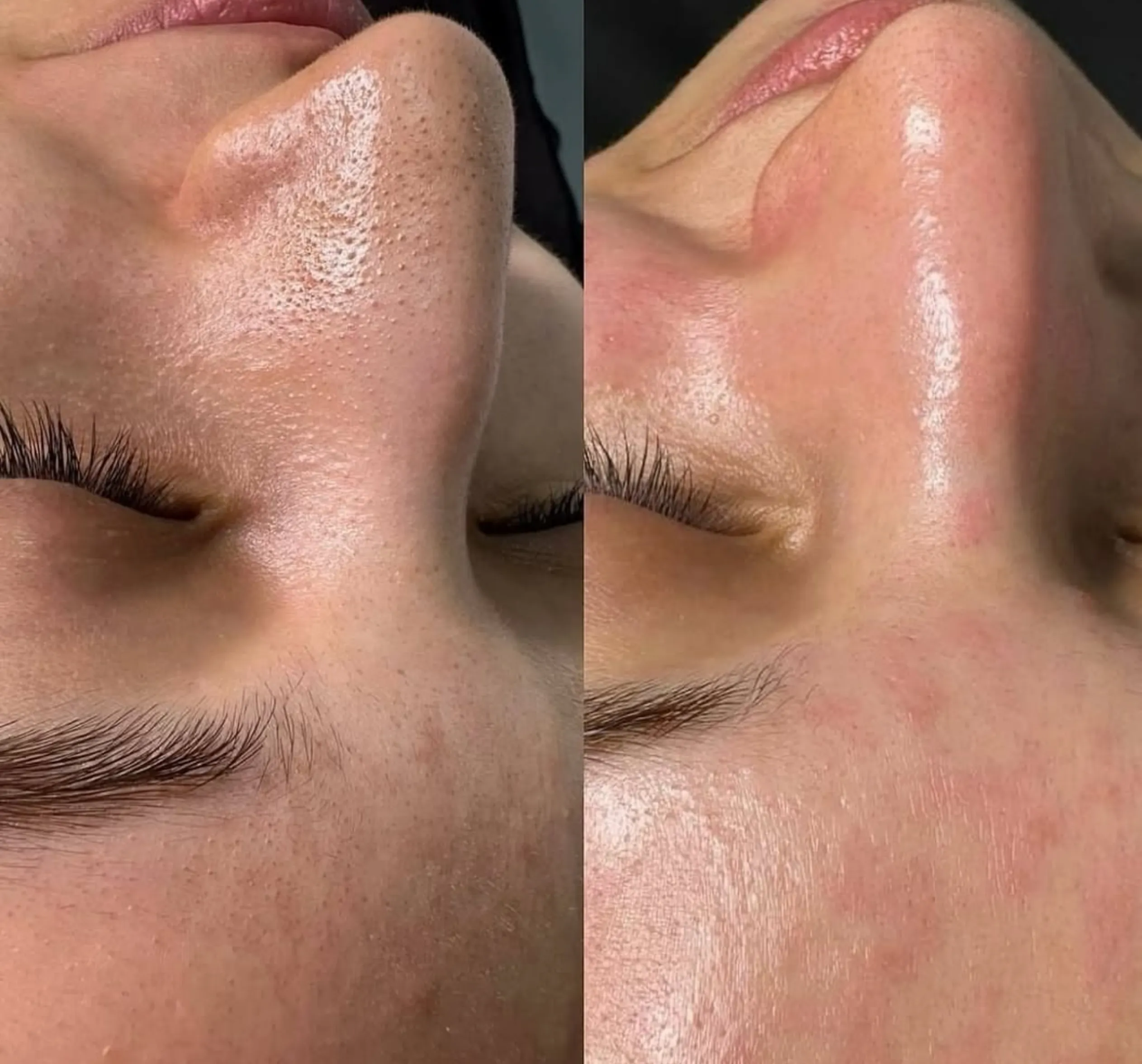 correct order of skincare