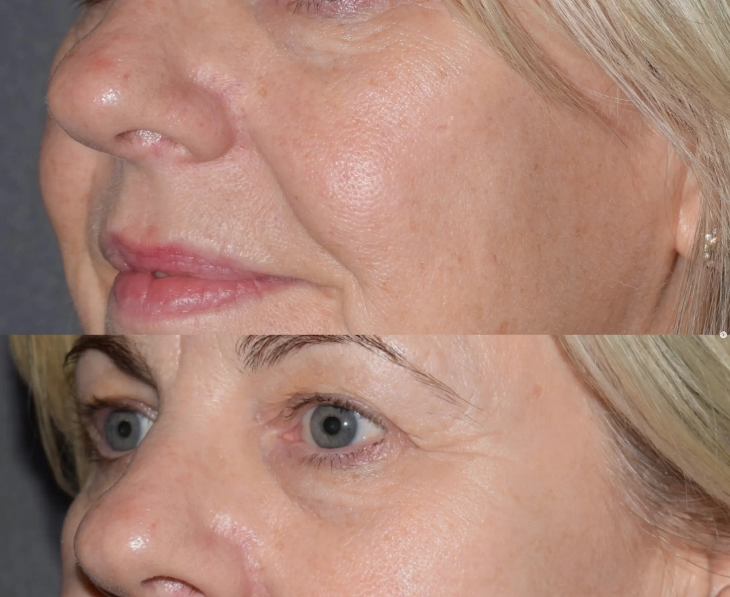 skincare routine step by step